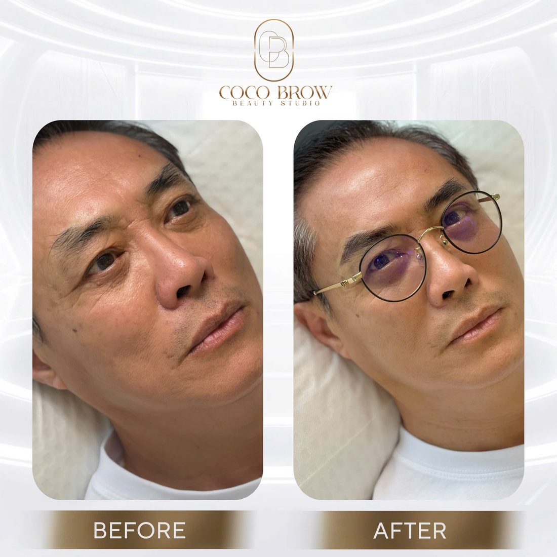 Eyebrow embroidery result by COCO BROW Singapore — photo 38